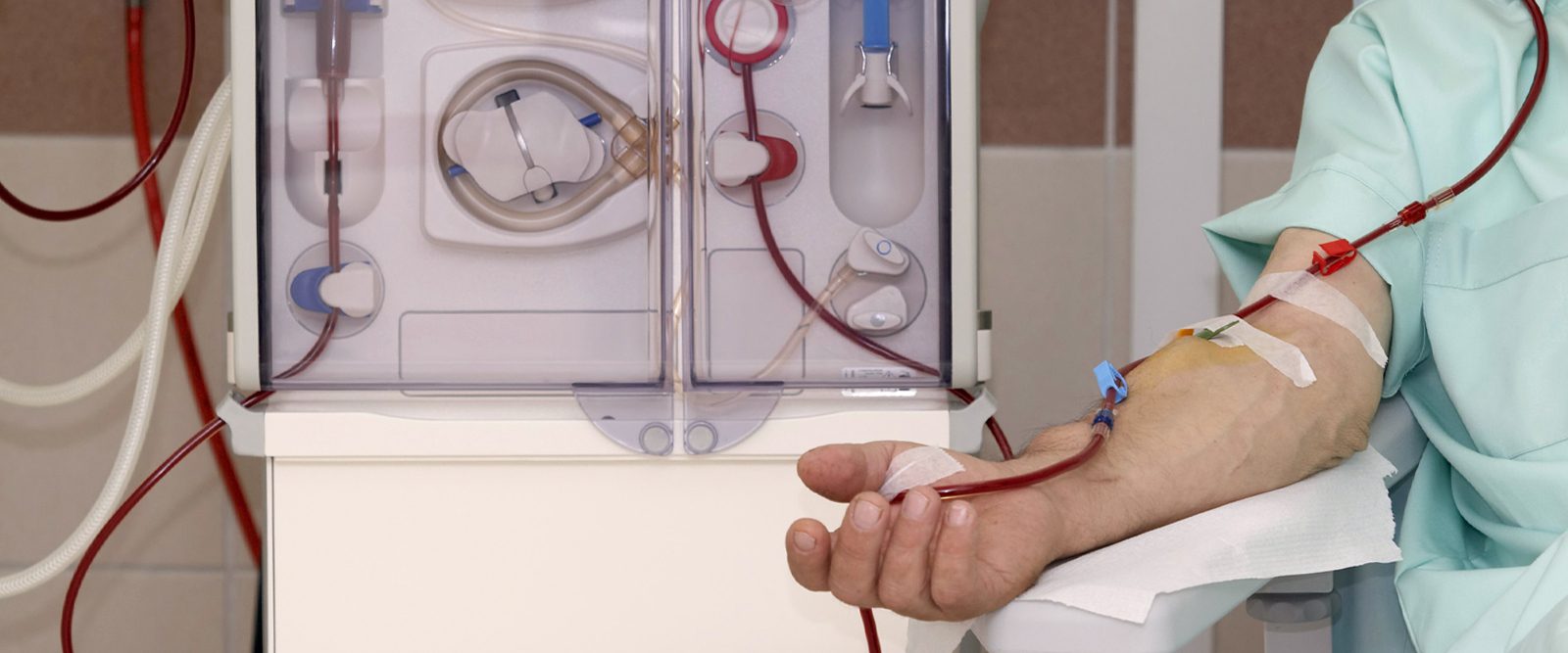 how does dialysis work